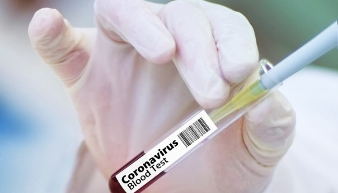 4 virus mortales para los que NO existe vacuna