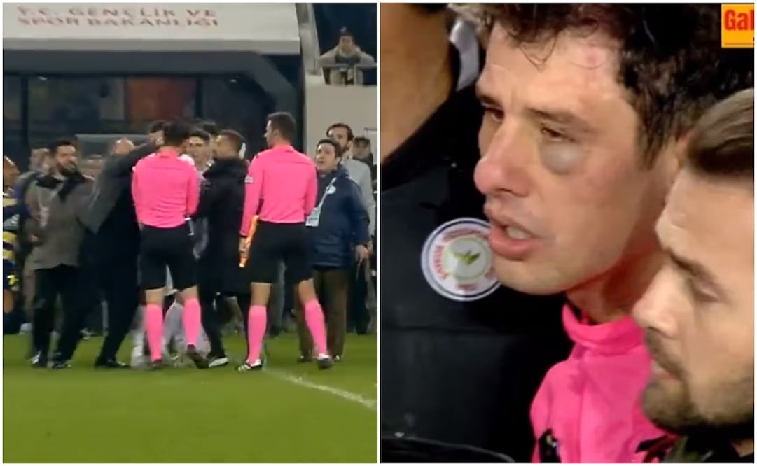 Momento en que el presidente del Ankarugucu golpea al árbitro y resultado de la agresión / FOTOS: Captura