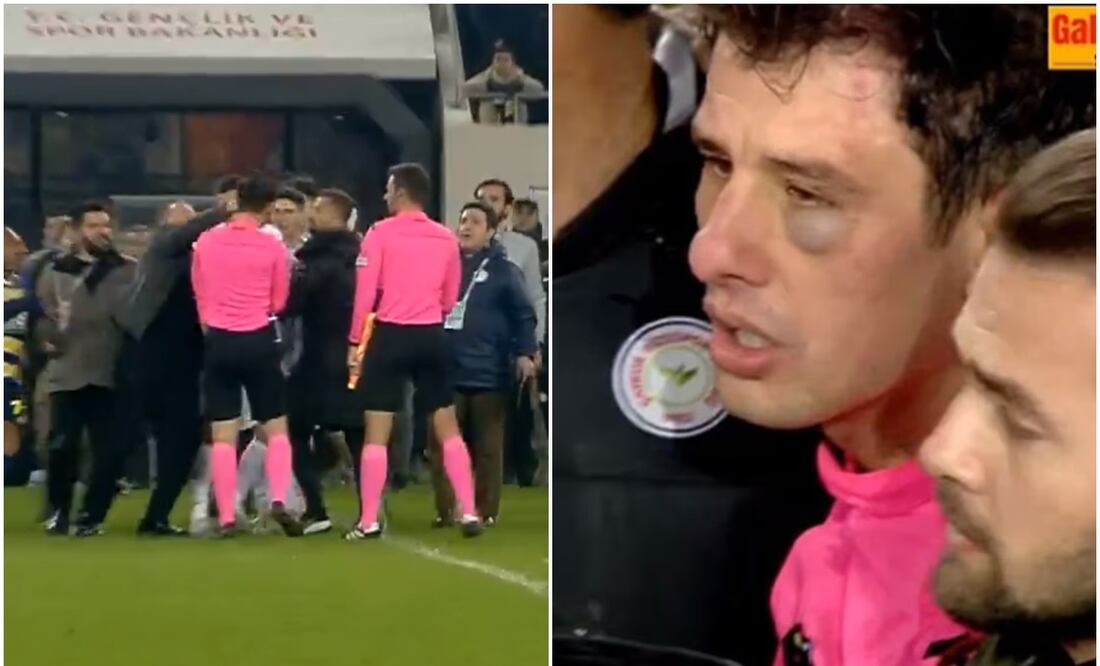 Momento en que el presidente del Ankarugucu golpea al árbitro y resultado de la agresión / FOTOS: Captura