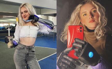 De bebé tuvo una amputación, hoy es la influencer con brazos biónicos