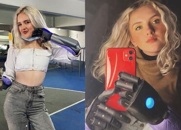 De bebé tuvo una amputación, hoy es la influencer con brazos biónicos