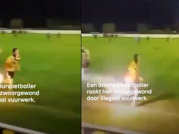 Futbolista casi pierde la mano por levantar un petardo que explotó segundos después