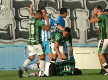 Jugador de la Segunda División de Argentina sufre grave lesión en pleno partido