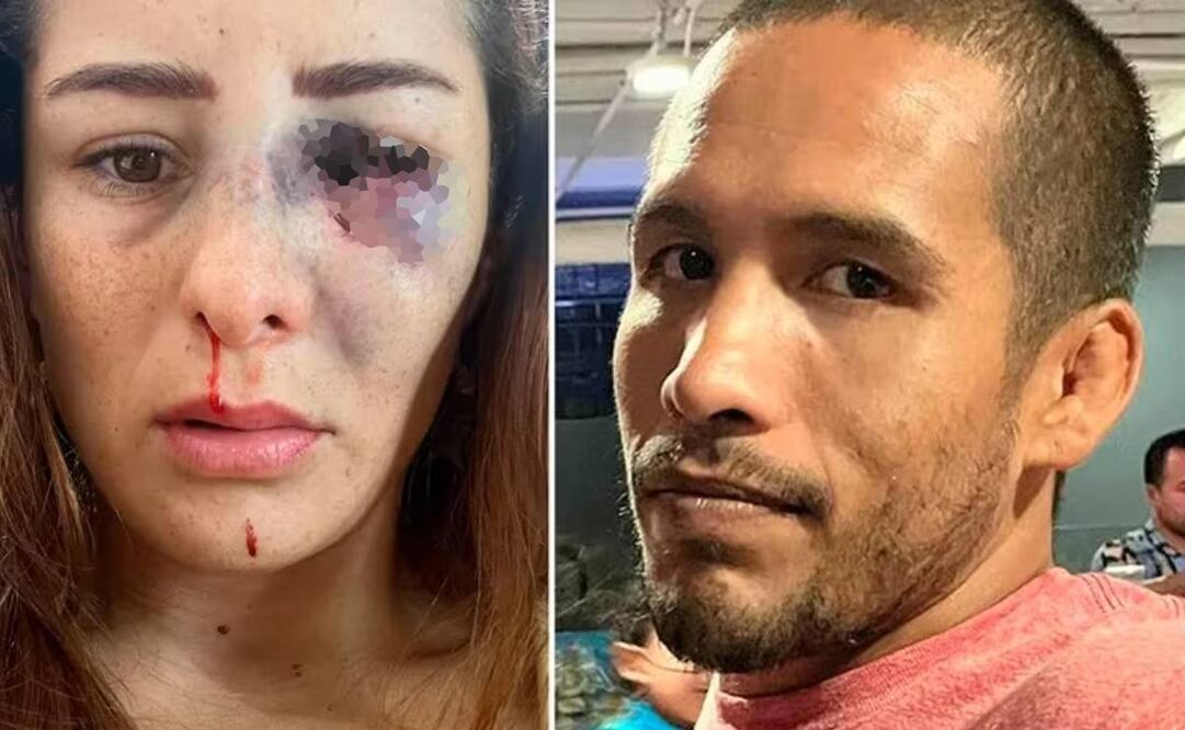 Daniela López Mejía denunció que el padre de su hija le propinó una brutal golpiza. Foto: Especial