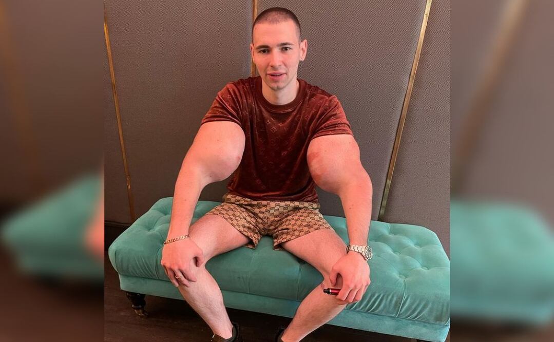 Foto: Instagram @ruki_bazuki_official