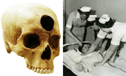 10 tratamientos médicos inhumanos que marcaron a la humanidad