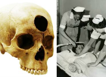 10 tratamientos médicos inhumanos que marcaron a la humanidad