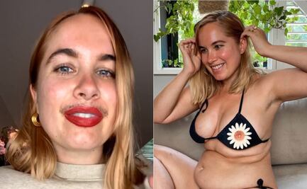 Influencer presume sus “imperfecciones” para romper estándares de belleza