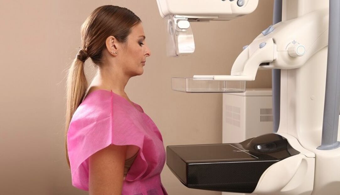 Mastografía, el estudio fundamental para las mujeres mayores de 40 años