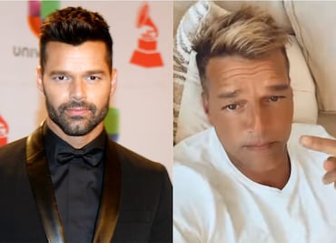 ¿Qué le pasó a Ricky Martin en el rostro? Así luce el cantante hoy