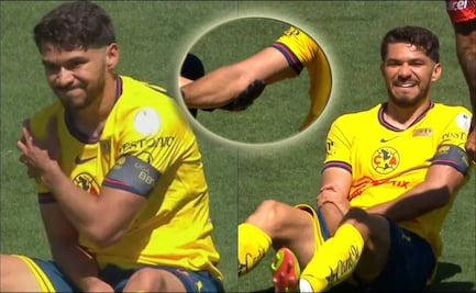 ¡Alarmas en el Nido! Henry Martín terminó con lesión en el codo tras la obtención de la Supercopa MX