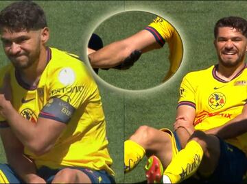 ¡Alarmas en el Nido! Henry Martín terminó con lesión en el codo tras la obtención de la Supercopa MX