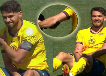 ¡Alarmas en el Nido! Henry Martín terminó con lesión en el codo tras la obtención de la Supercopa MX