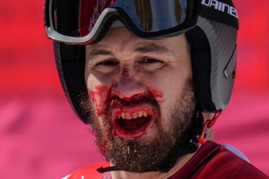 Las caídas y golpes más aparatosos de los atletas en Beijing 2022