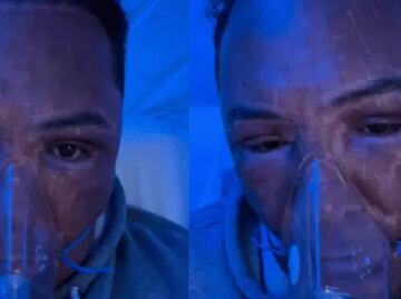 Óscar de la Hoya preocupa a sus seguidores con foto de su rostro desfigurado ¿Qué le pasó?