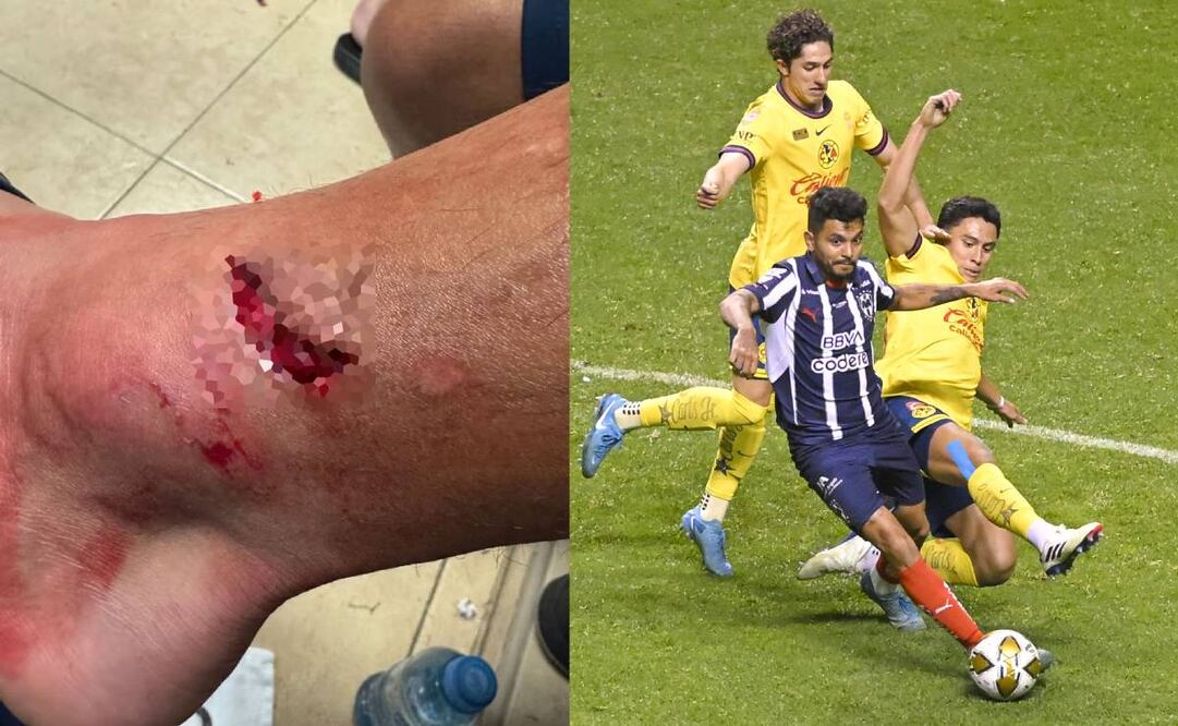 Tecatito Corona acabó con una seria lesión tras la plancha de Ramón Juárez en el América vs Monterey. Foto: Especial