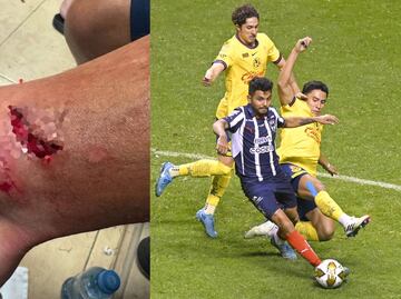 Tecatito Corona mostró la tremenda herida que le hizo Ramón Juárez ¿Debió ser expulsión?