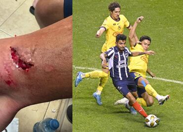 Tecatito Corona mostró la tremenda herida que le hizo Ramón Juárez ¿Debió ser expulsión?