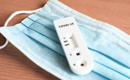 Investigadores preparan económico sensor que detecta Covid con saliva