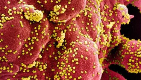 10 imágenes de microscopio de cómo luce el coronavirus realmente