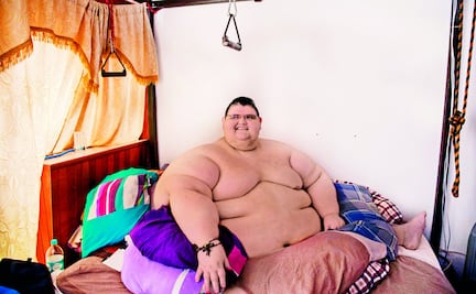 El “hombre más obeso del mundo” es mexicano y lucha por perder peso
