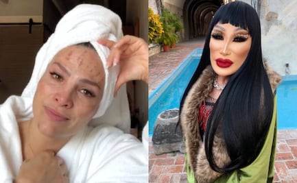 5 famosas mexicanas que se arrepintieron de sus tratamientos estéticos