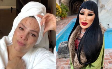 5 famosas mexicanas que se arrepintieron de sus tratamientos estéticos