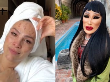 5 famosas mexicanas que se arrepintieron de sus tratamientos estéticos