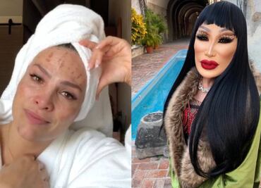 5 famosas mexicanas que se arrepintieron de sus tratamientos estéticos