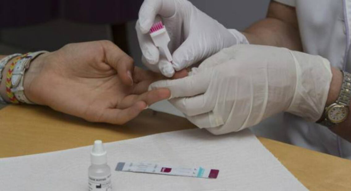 La prueba de VIH ya se vende en farmacias y ¡sin receta!