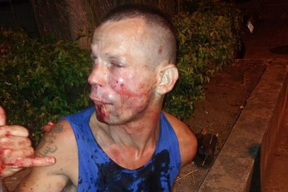 Luchadora de la UFC dio tremenda golpiza a su asaltante