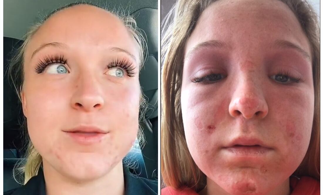 Foto: TikTok @emmahoffstrm