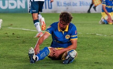 Igor Lichnovsky fue operado y se desconoce cuánto tiempo estará sin jugar con el América