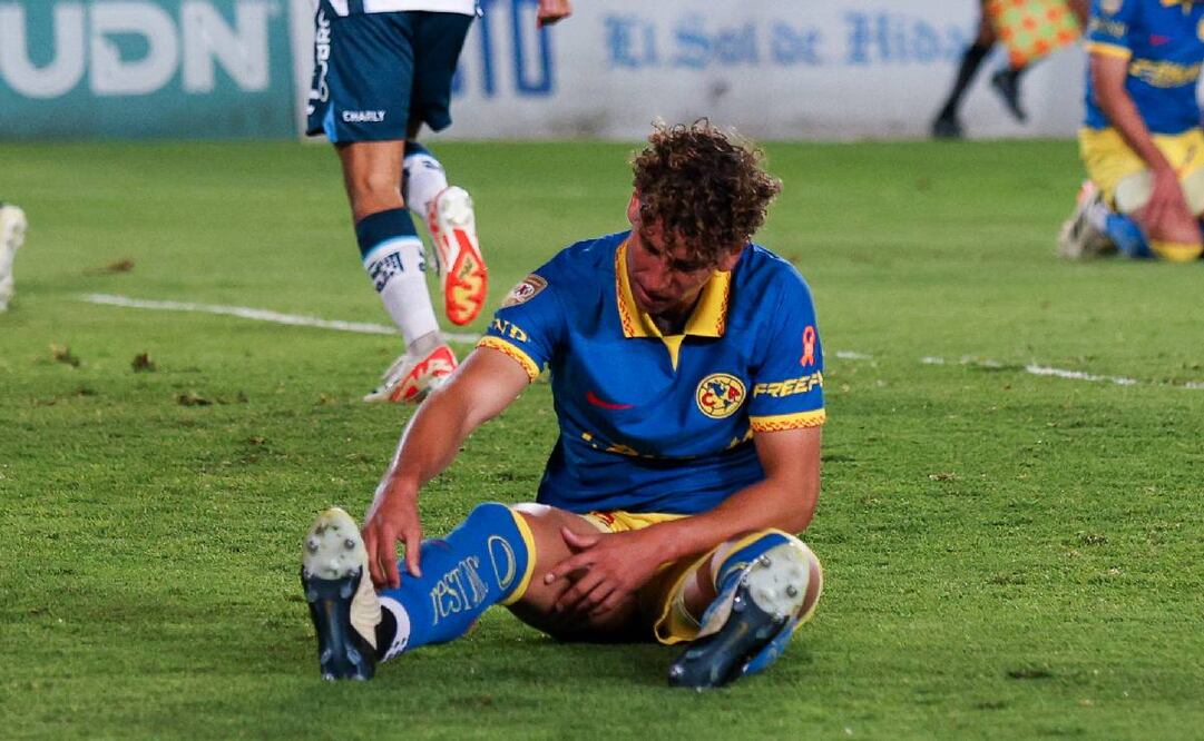 Igor Lichnovsky fue operado de una serie lesión en la rodilla derecha y será baja por tiempo indefinido. Foto: Imago7