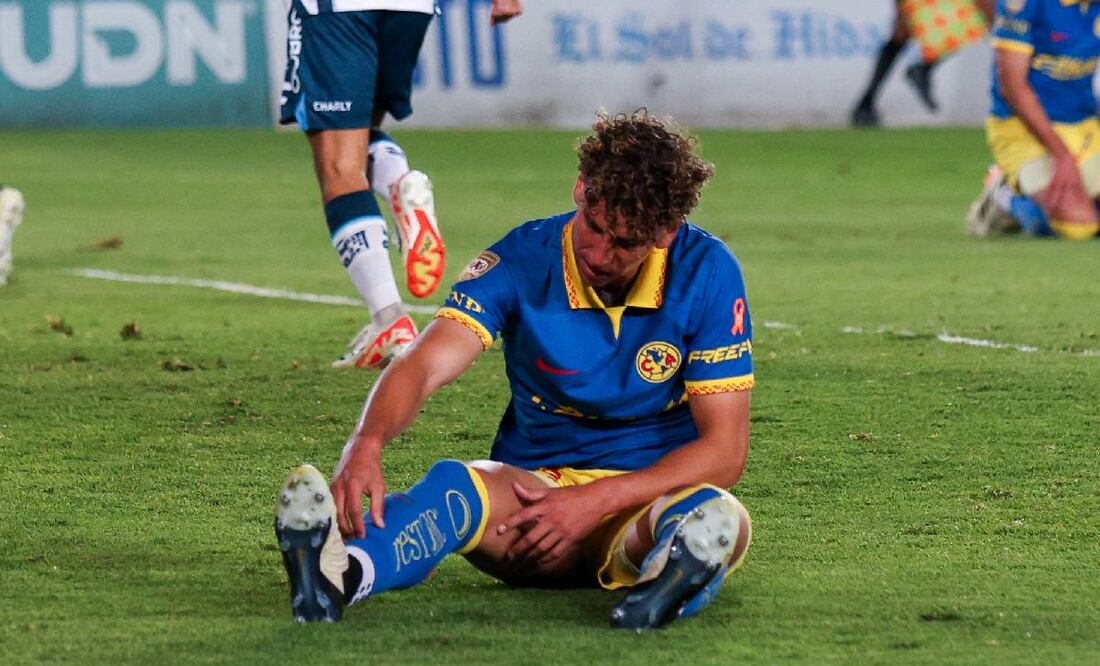 Igor Lichnovsky fue operado de una serie lesión en la rodilla derecha y será baja por tiempo indefinido. Foto: Imago7