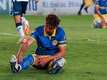 Igor Lichnovsky fue operado y se desconoce cuánto tiempo estará sin jugar con el América
