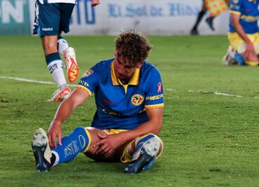 Igor Lichnovsky fue operado y se desconoce cuánto tiempo estará sin jugar con el América