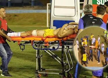 ¡Lamentable hecho en el futbol brasileño! Policía hiere de bala a portero tras discusión en partido