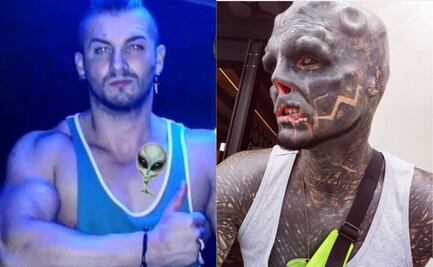 Anthony Loffredo, el hombre que mutila su cuerpo para ser un alien