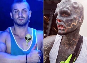 Anthony Loffredo, el hombre que mutila su cuerpo para ser un alien