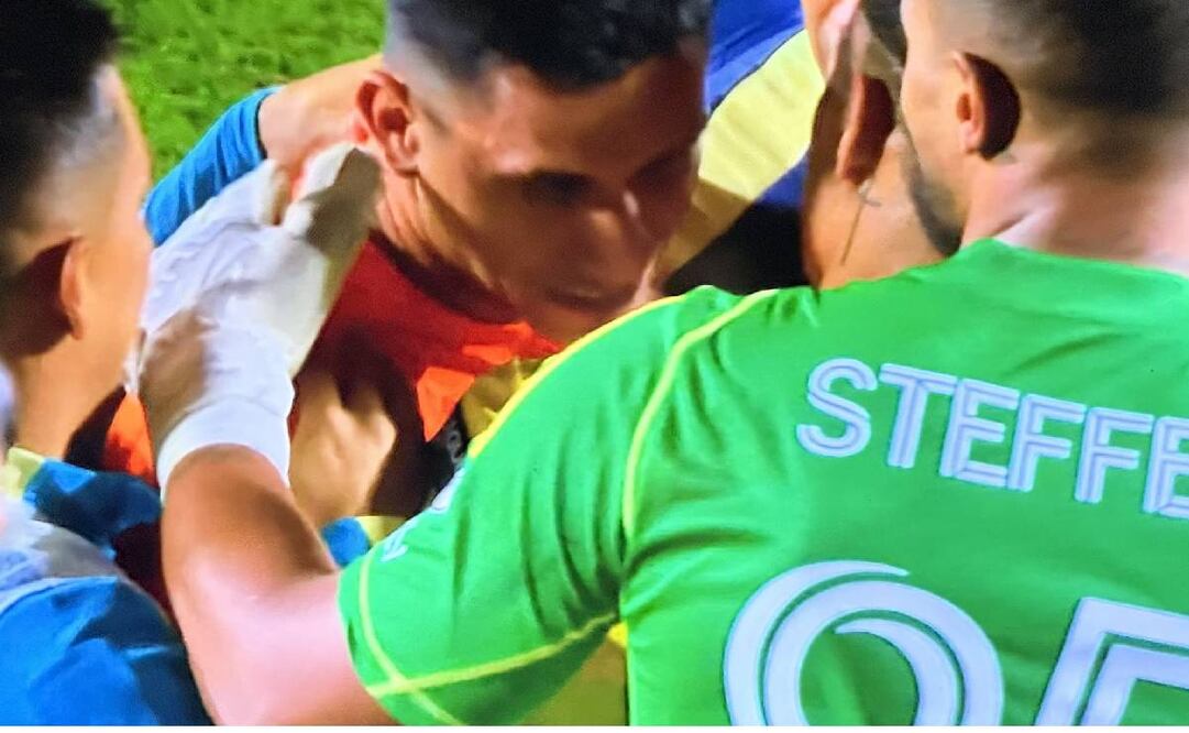 Luis Malagón rompió en llanto cuando falló el penalti que fue la eliminación del América en la Leagues Cup. Foto: Especial