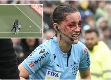 Camarógrafo golpeó de forma brutal a árbitro asistente en partido del Betis