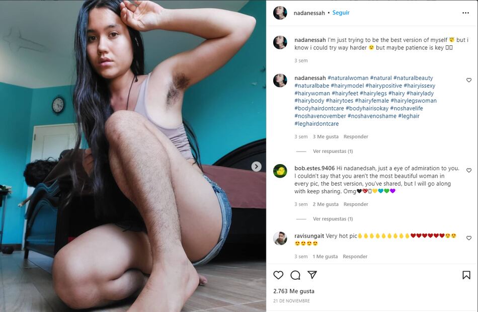 Fotos de mujeres que muestran su vello corporal se hacen virales
