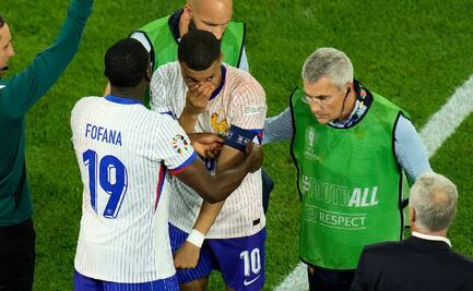 Fractura de Kylian Mbappé en la Eurocopa es menos grave de lo que se pensaba