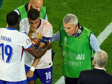 Fractura de Kylian Mbappé en la Eurocopa es menos grave de lo que se pensaba
