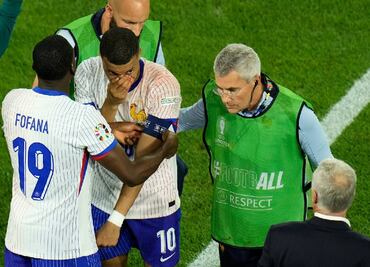 Fractura de Kylian Mbappé en la Eurocopa es menos grave de lo que se pensaba