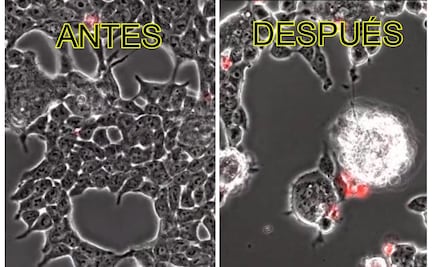 Video muestra como la Covid-19 ataca a las células del cerebro