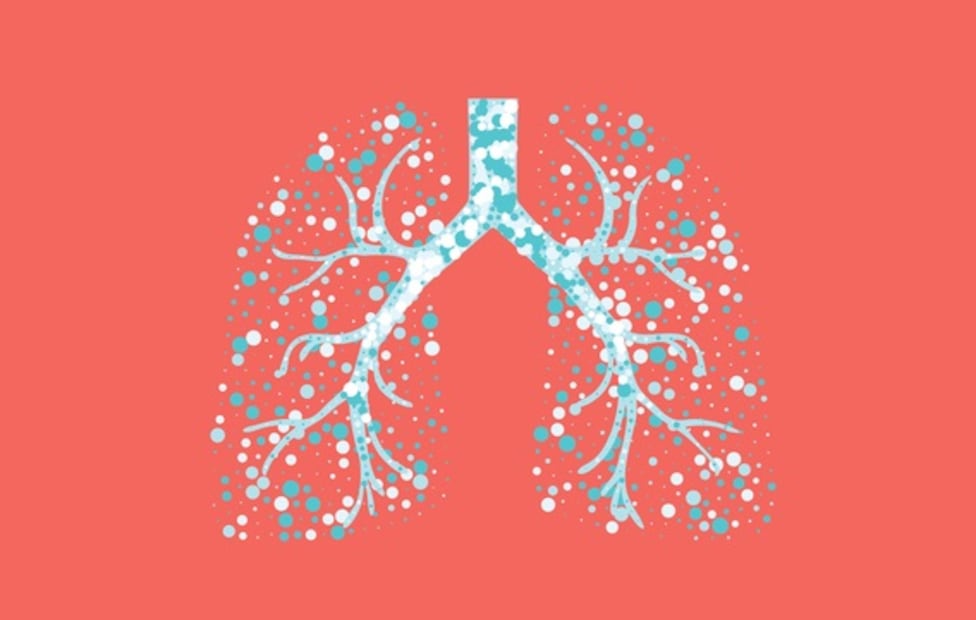 ¿Qué pasa en los pulmones cuando hay infección por Covid-19?