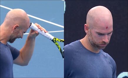 VIDEO: Tenista se abrió la frente golpeándose con su raqueta tras reaccionar de manera violenta ante un error