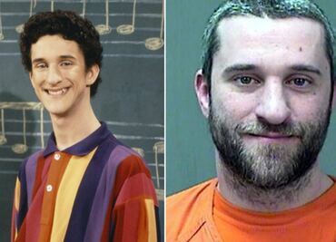 Dustin Diamond: ¿Qué pasó con Screech de “Salvados por la Campana”?